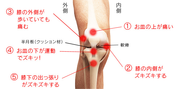 膝の構造